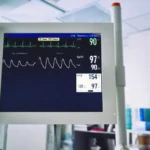 EKG Monitoring