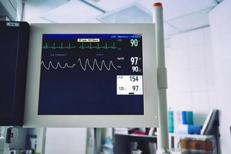 EKG Monitoring
